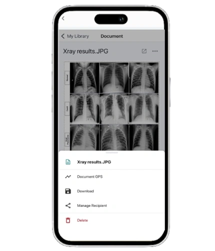 xray
